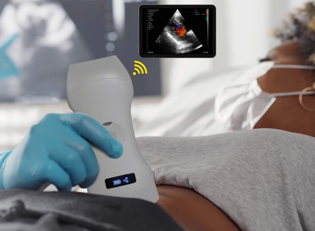 3in1 palm doppler ultrasound