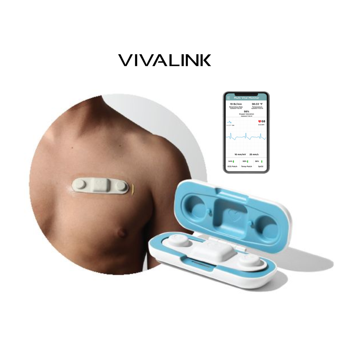 Wearable ECG Monitor