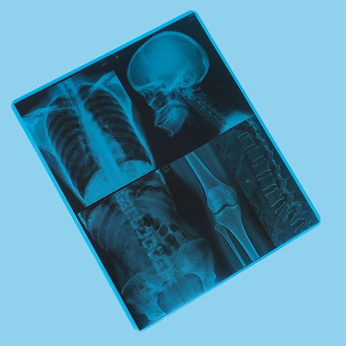 Medical X-ray Film (Inkjet Blue 210)